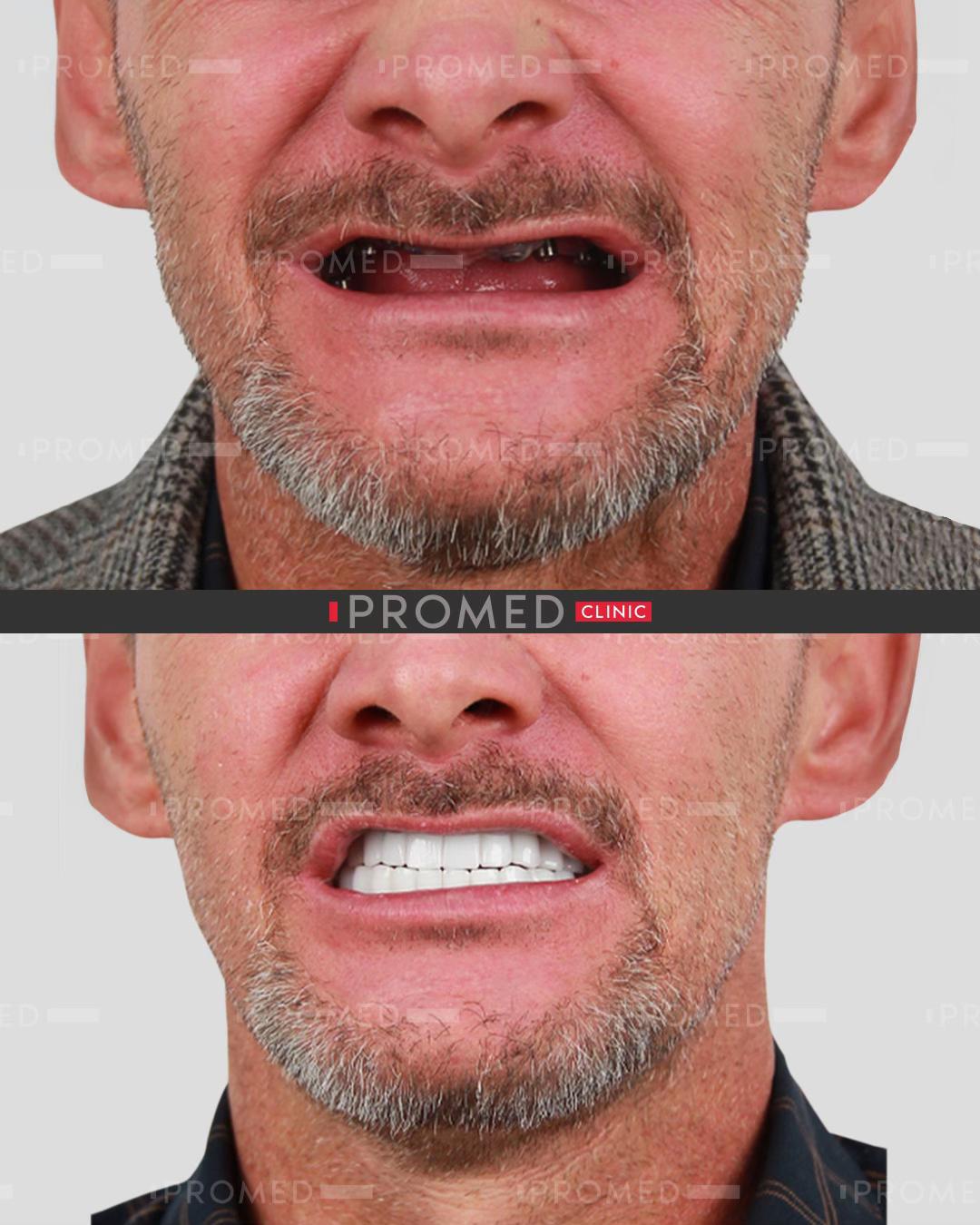 @promeddentalclinic