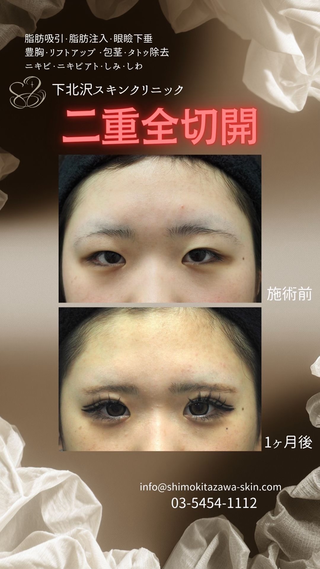 @下北沢スキンクリニック院長・こころの美容外科医・保坂宗孝