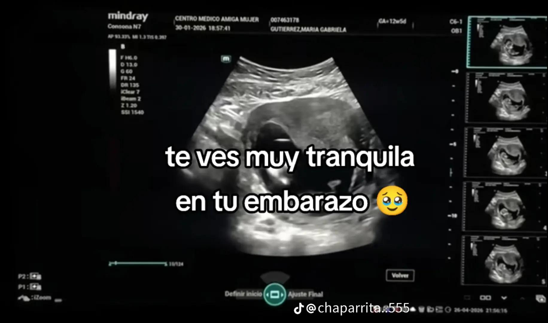 @Sandra Diaz
