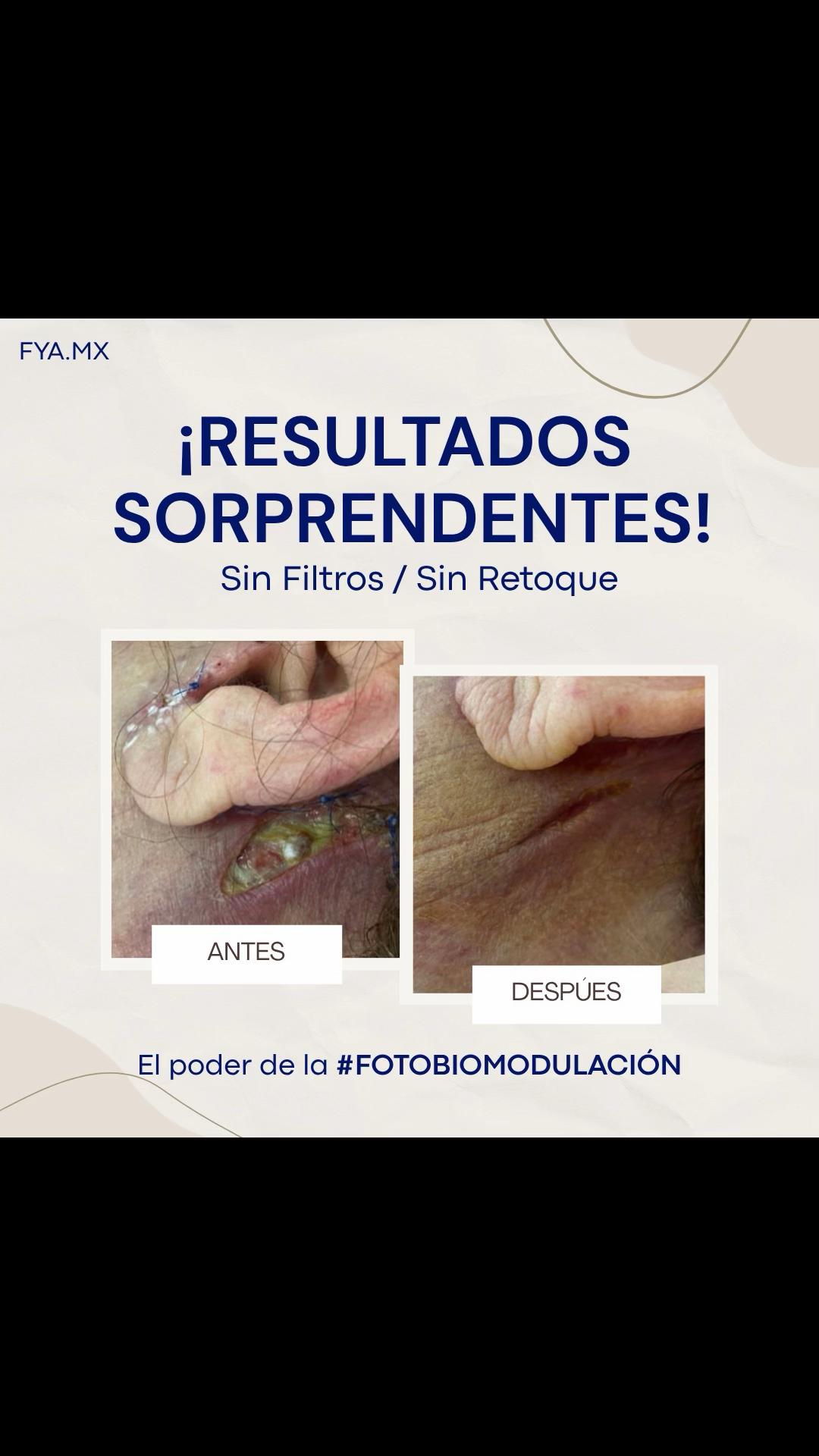 @FYA M&Eacute;XICO