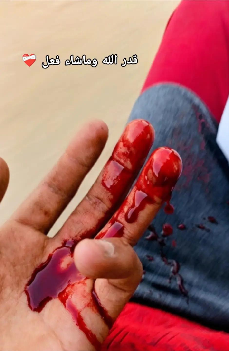 @أدهم توفيق 🦅🏴&zwj;☠️
