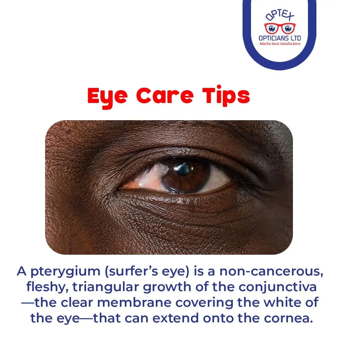 @Optex Opticians Ltd