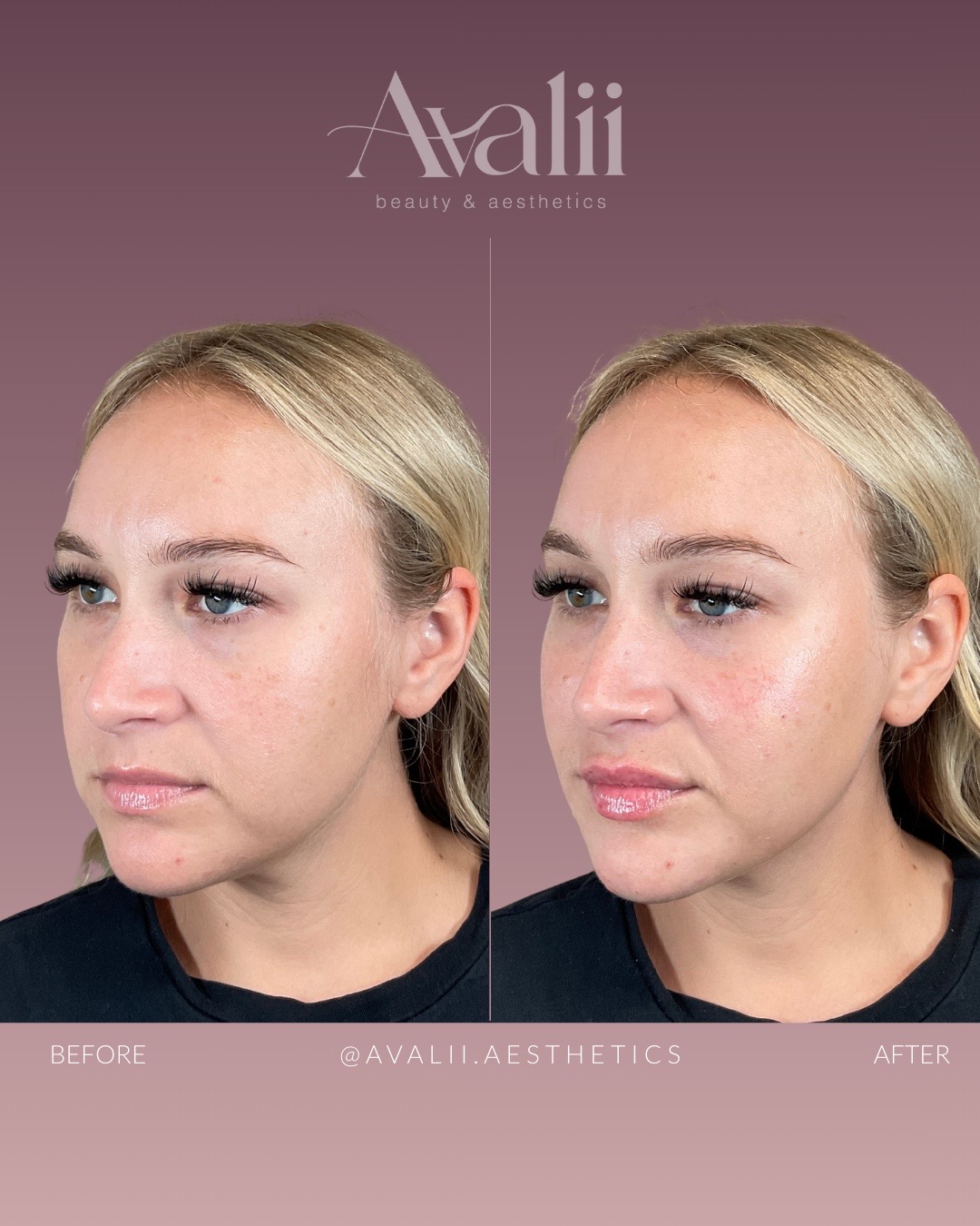 @Avalii Aesthetics