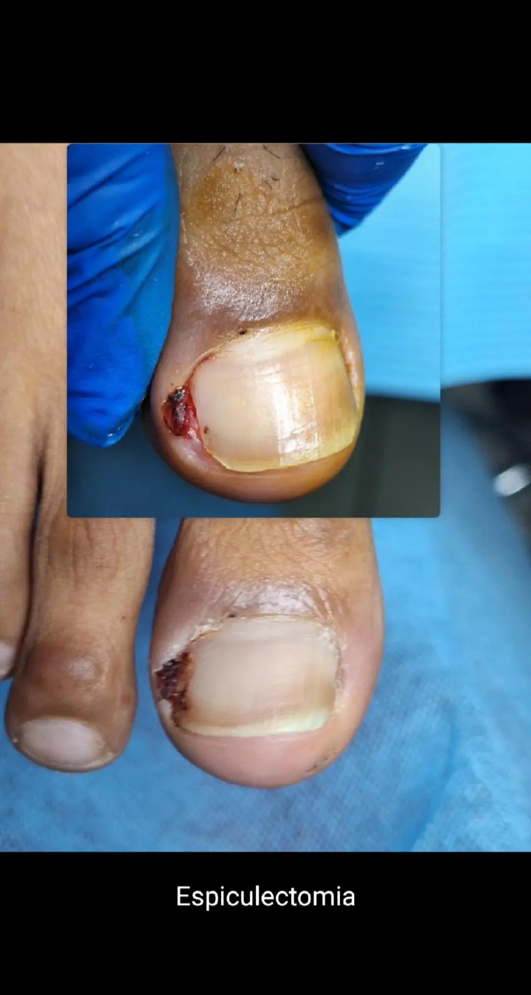 @Quiropodia HAPPY FOOT🇨🇷