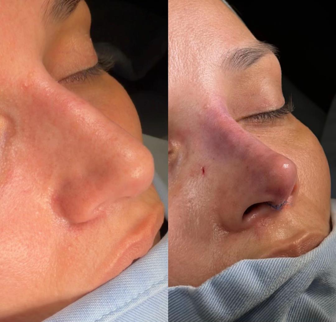 @Eliana Garcés Plastic Surgery