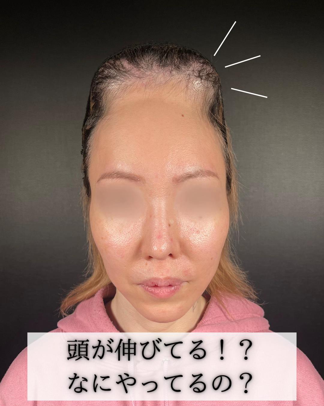 @鼻整形R Beauty CLINIC 副院長👨&zwj;⚕️吉田慧