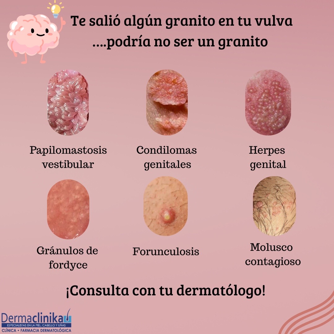 @Dermaclinika H100