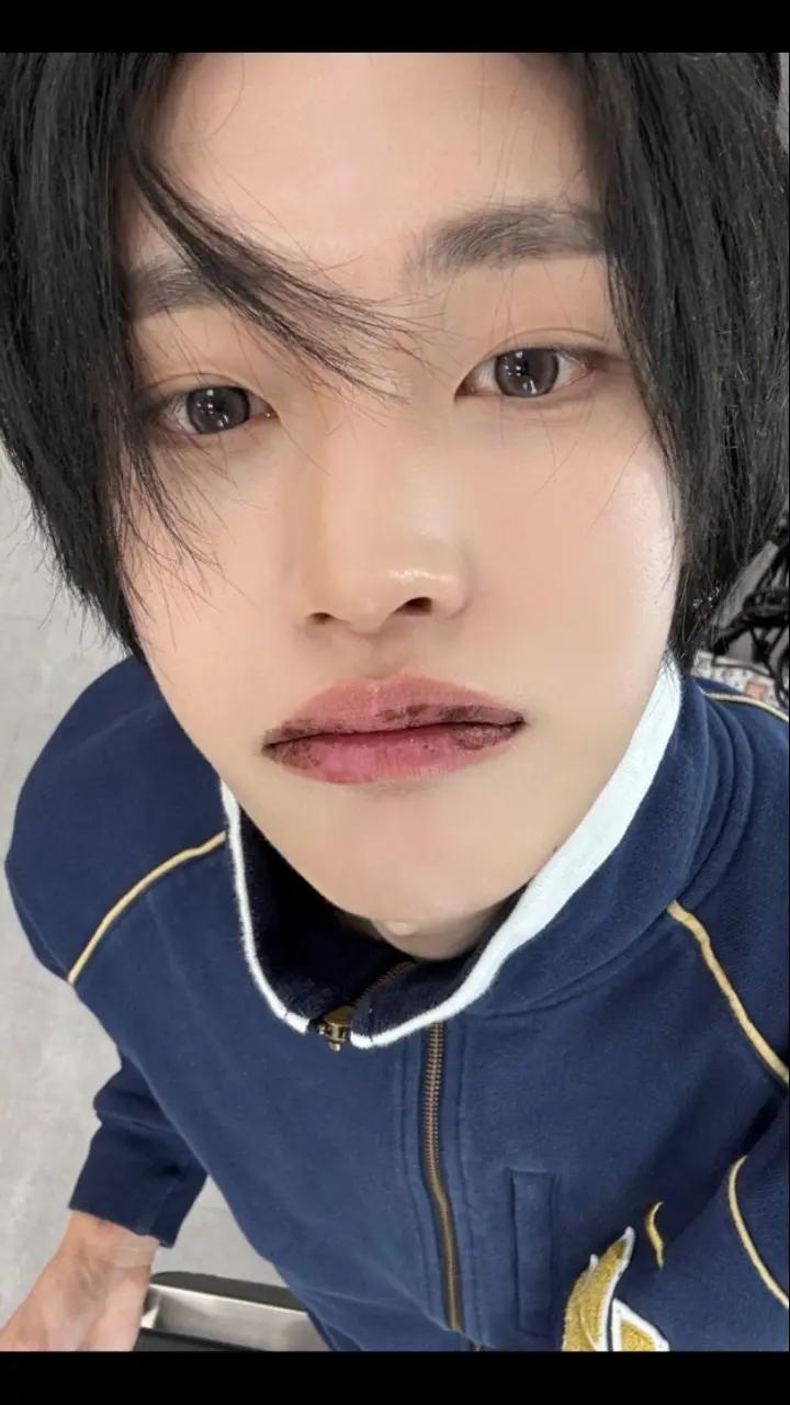 @鬱金香ANTON