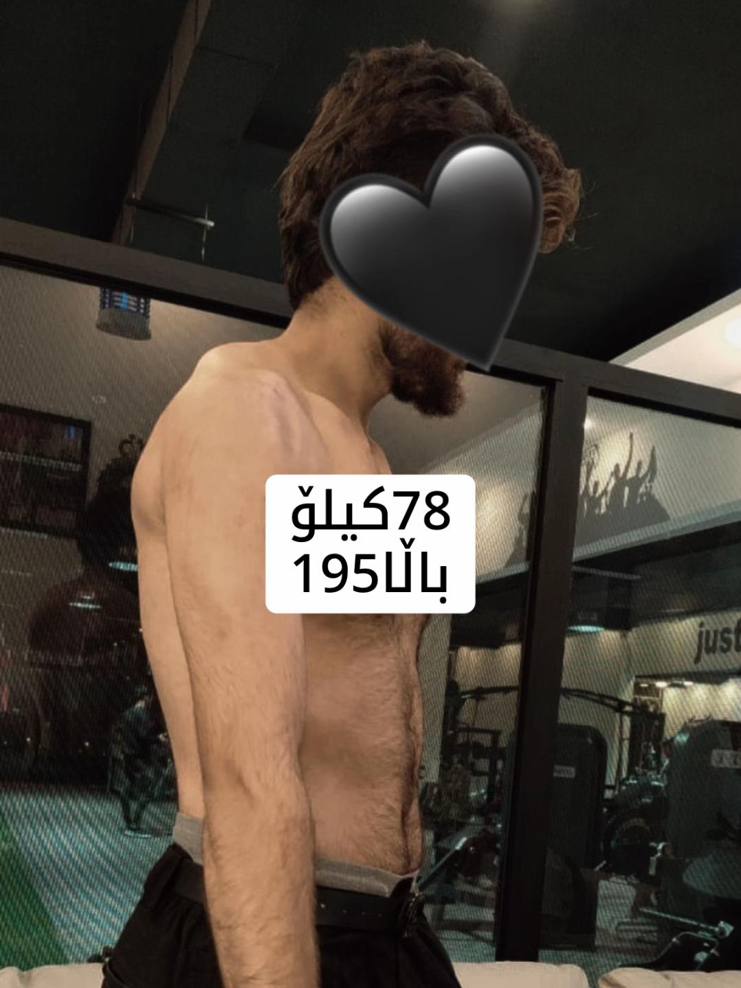 @Bawyane