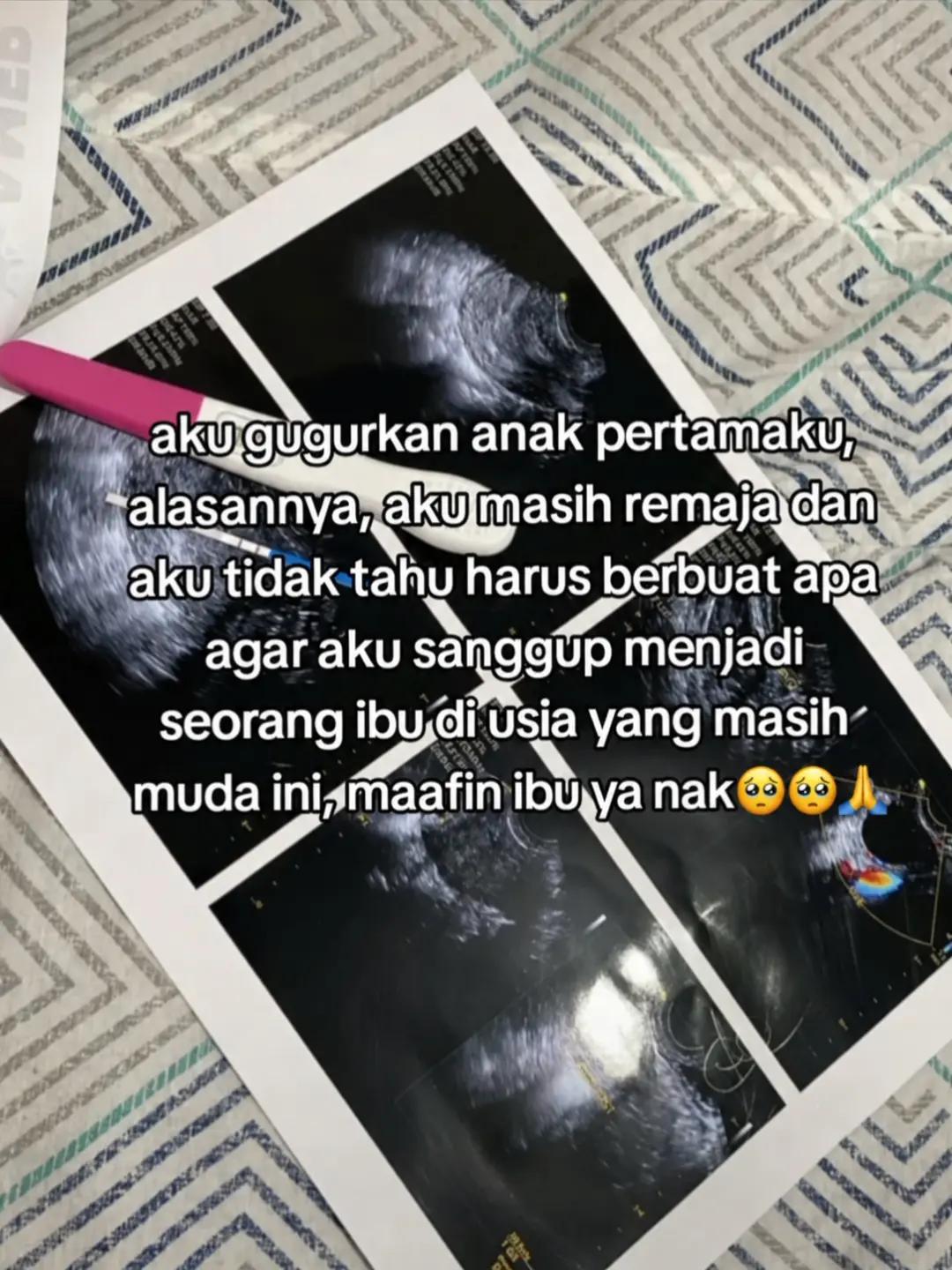 @Riska Saputri