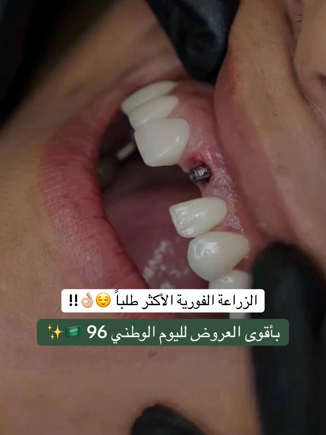 @عيادات البا للابتسامة