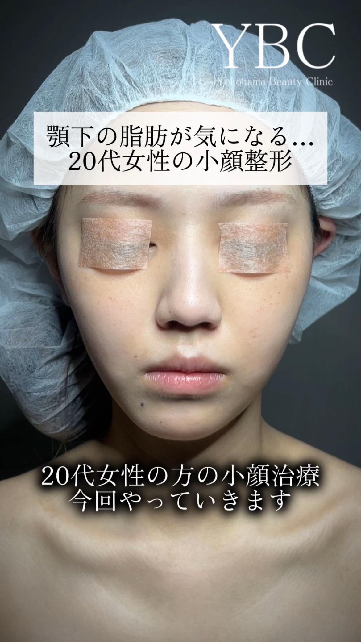 @イソセン/美容外科医（磯村亮輔院長）