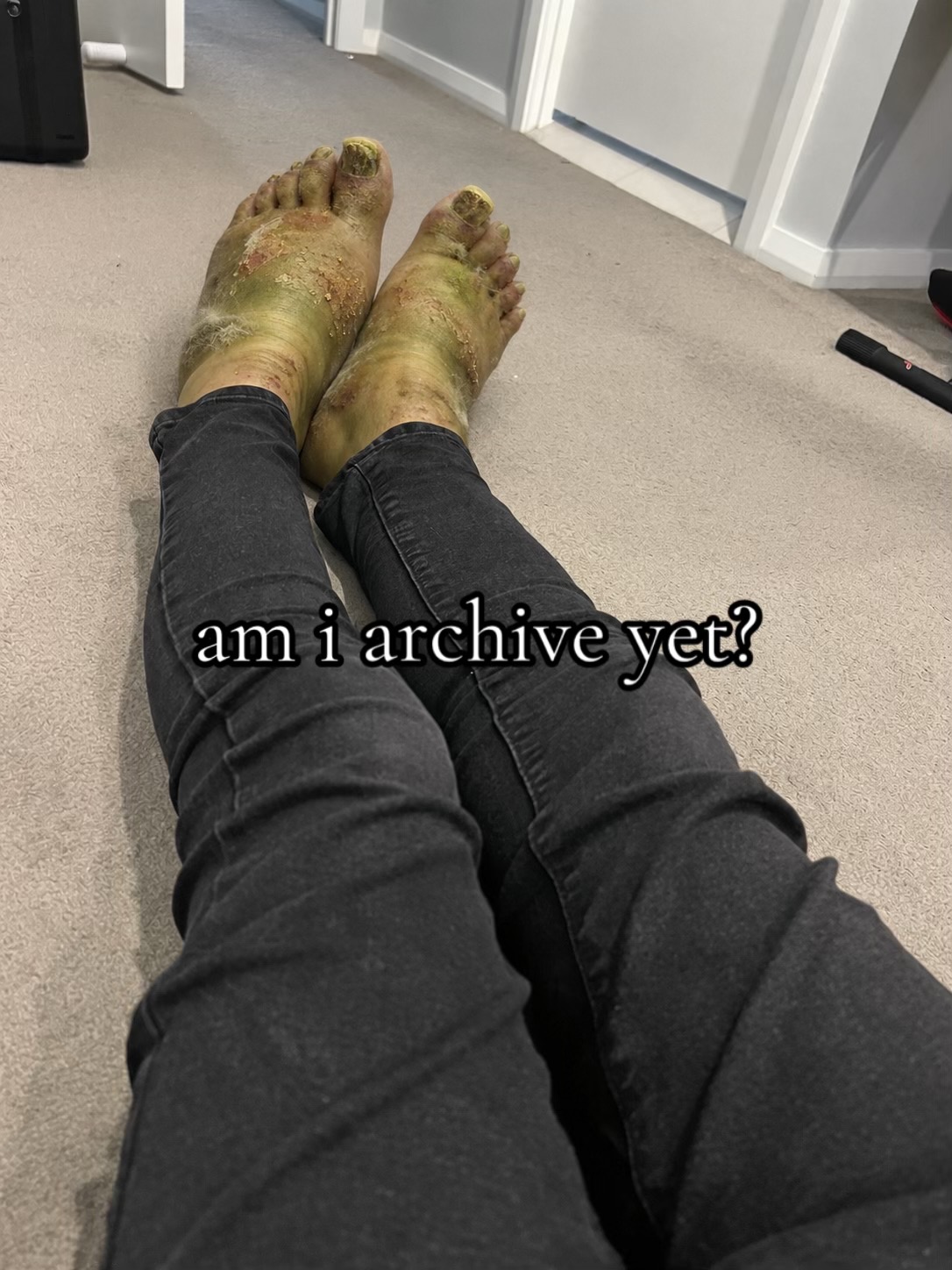 @śķ