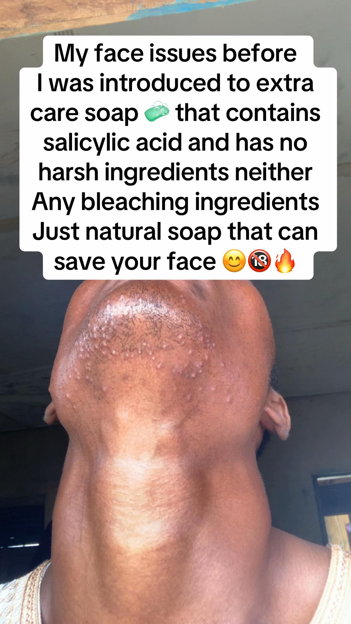@Nurudeen🥰