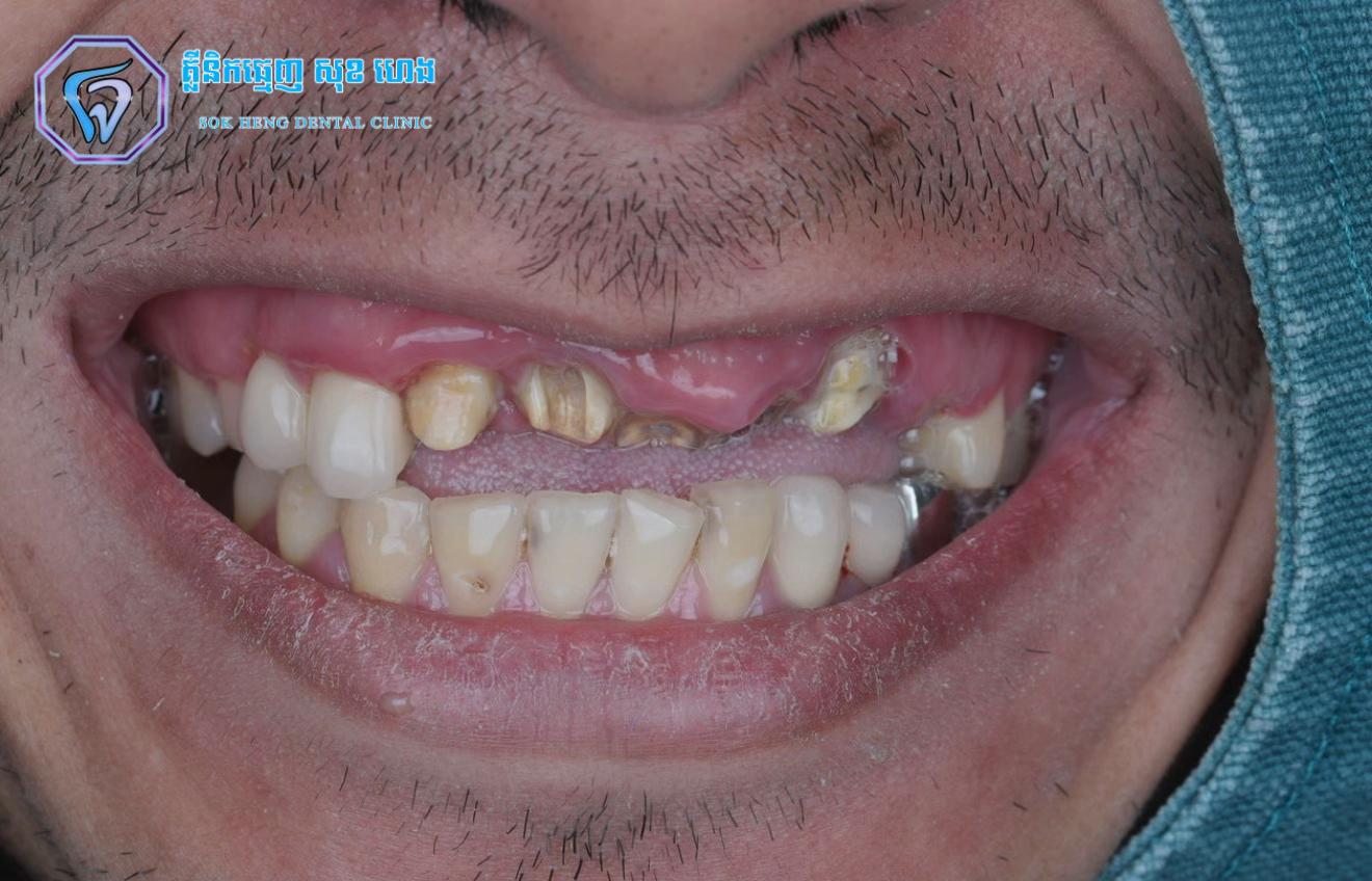 @ដុកទ័រធ្មេញ សុខហេង - Dokter