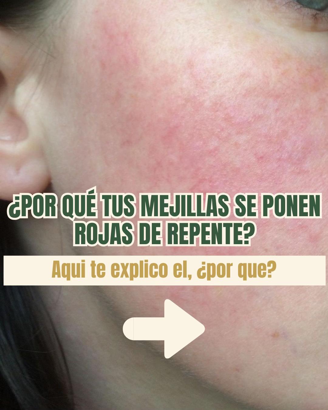 @Dra.Elba Chimarro