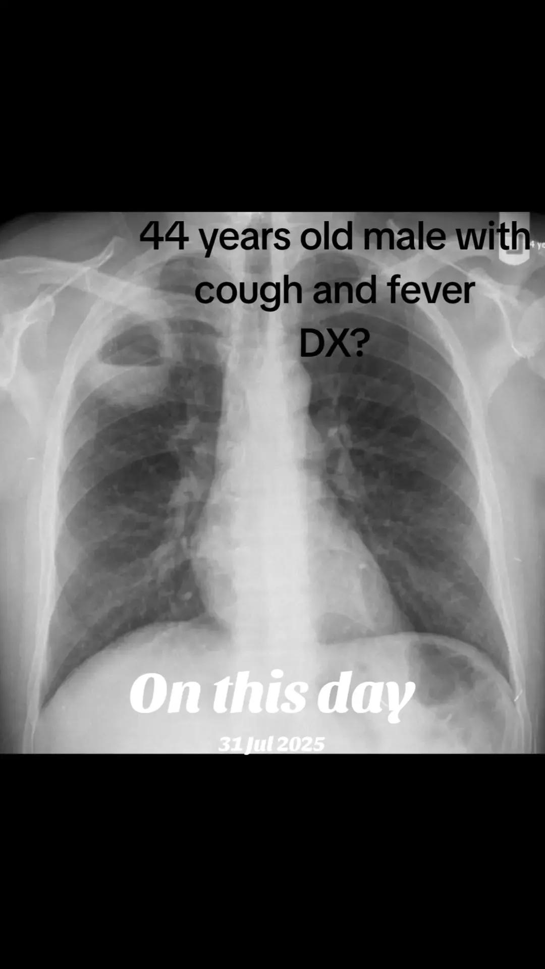 @Dr Wubie Endalew(Radiologist)