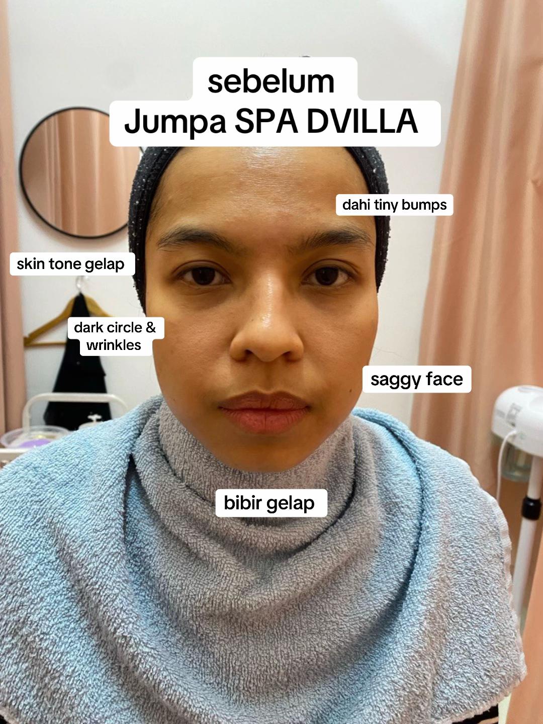 @SPA DVILLA SKIN & SLIM EXPERT