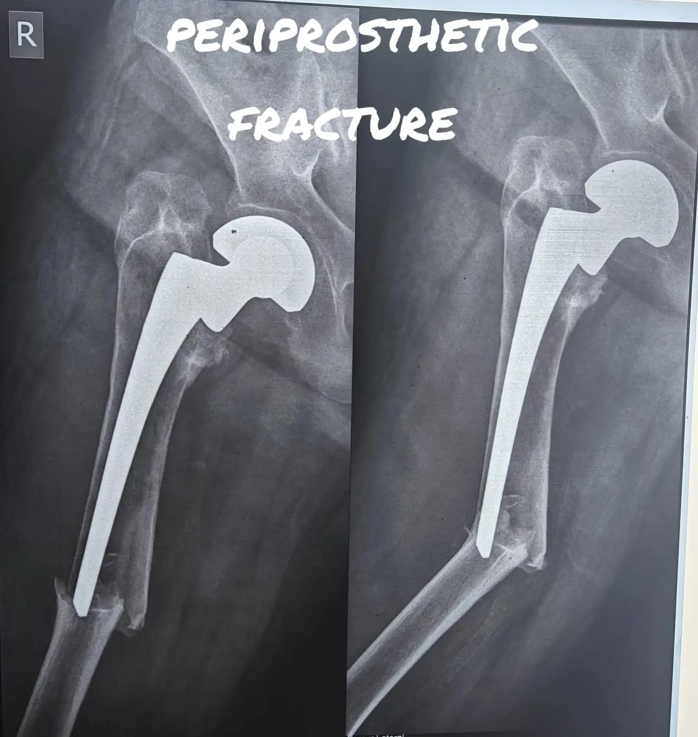 @Orthopedic_Surgeon_Arbind