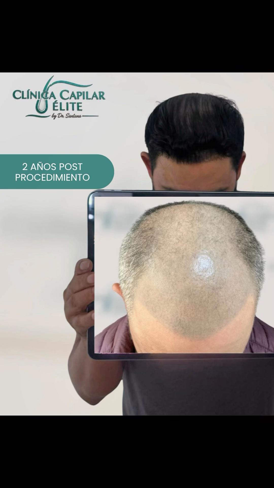 @Clínica Capilar Élite