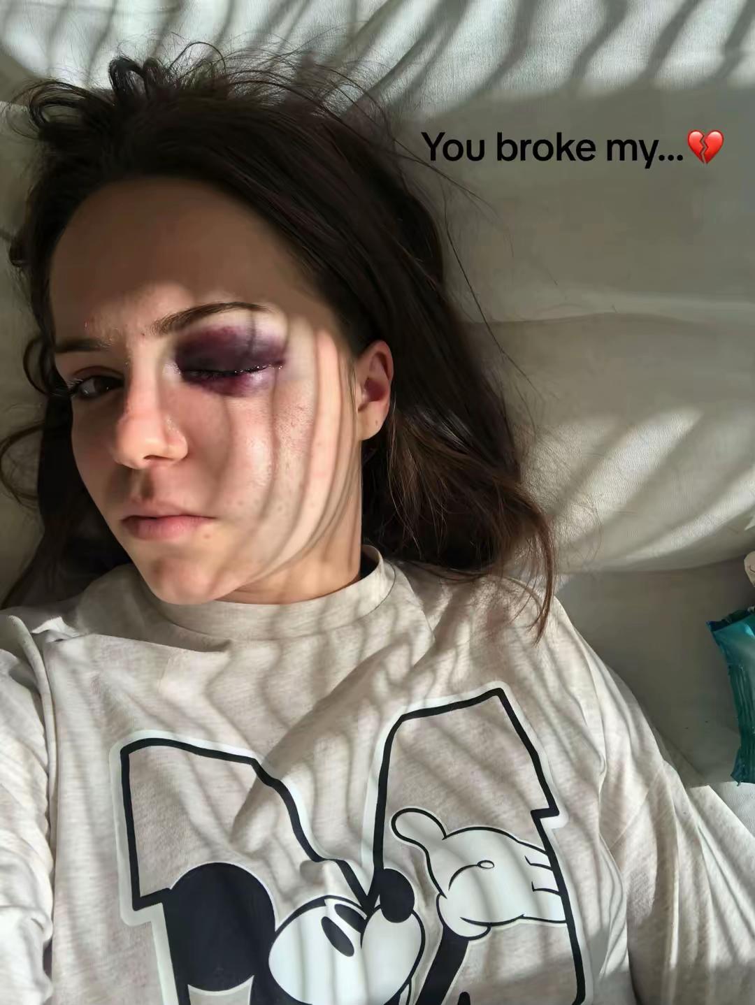 @MD