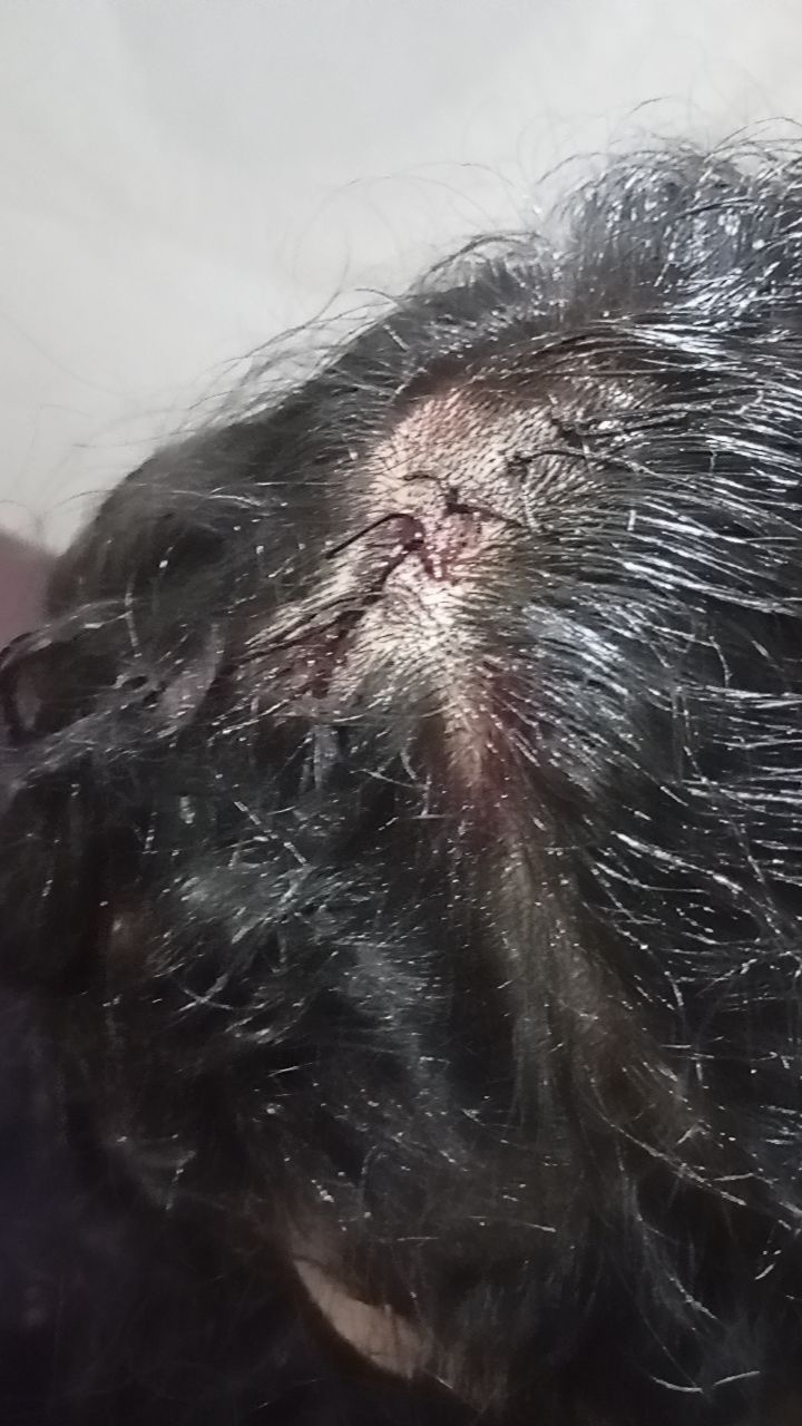@Allon butt happy