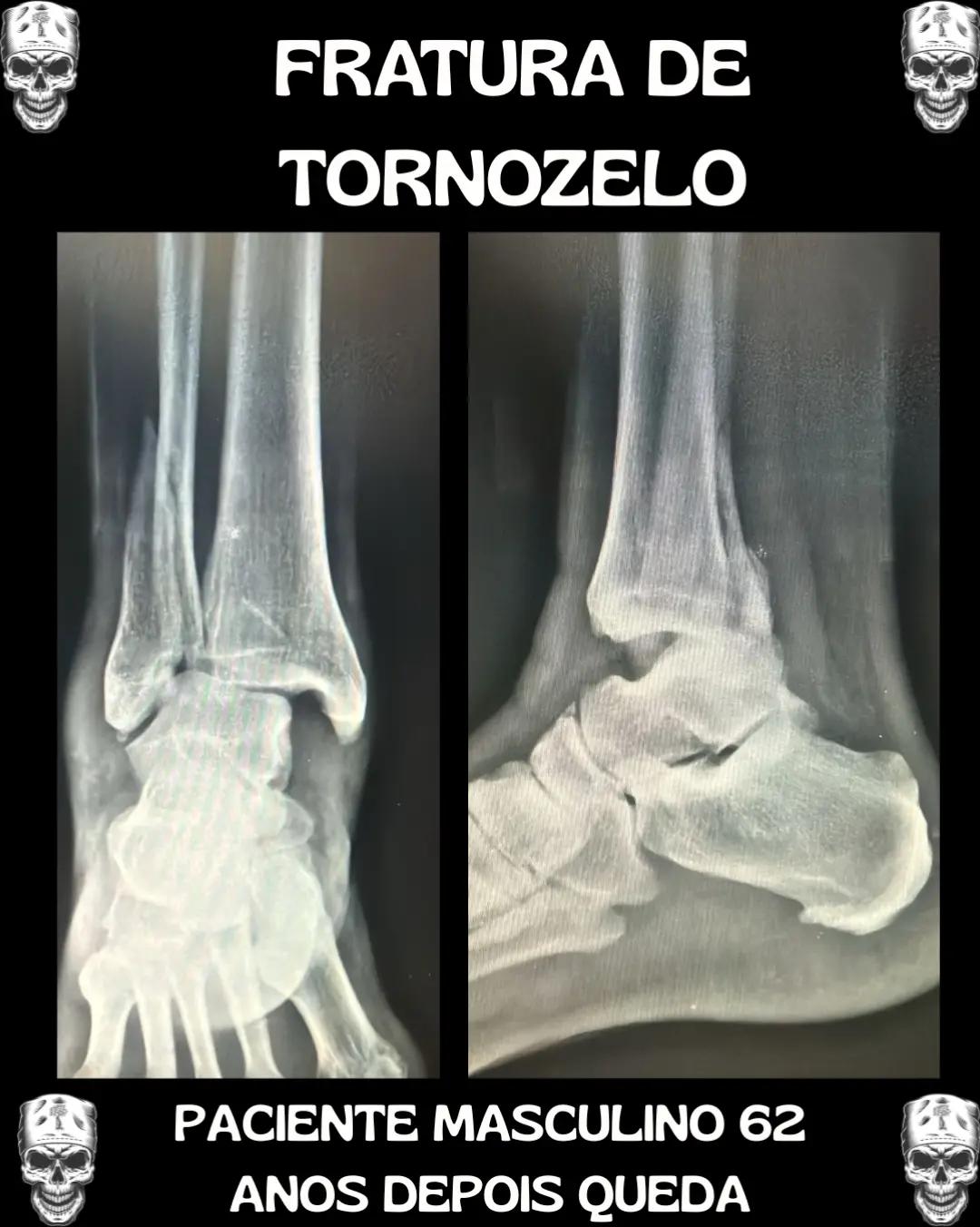 @Traumatologia Maluca