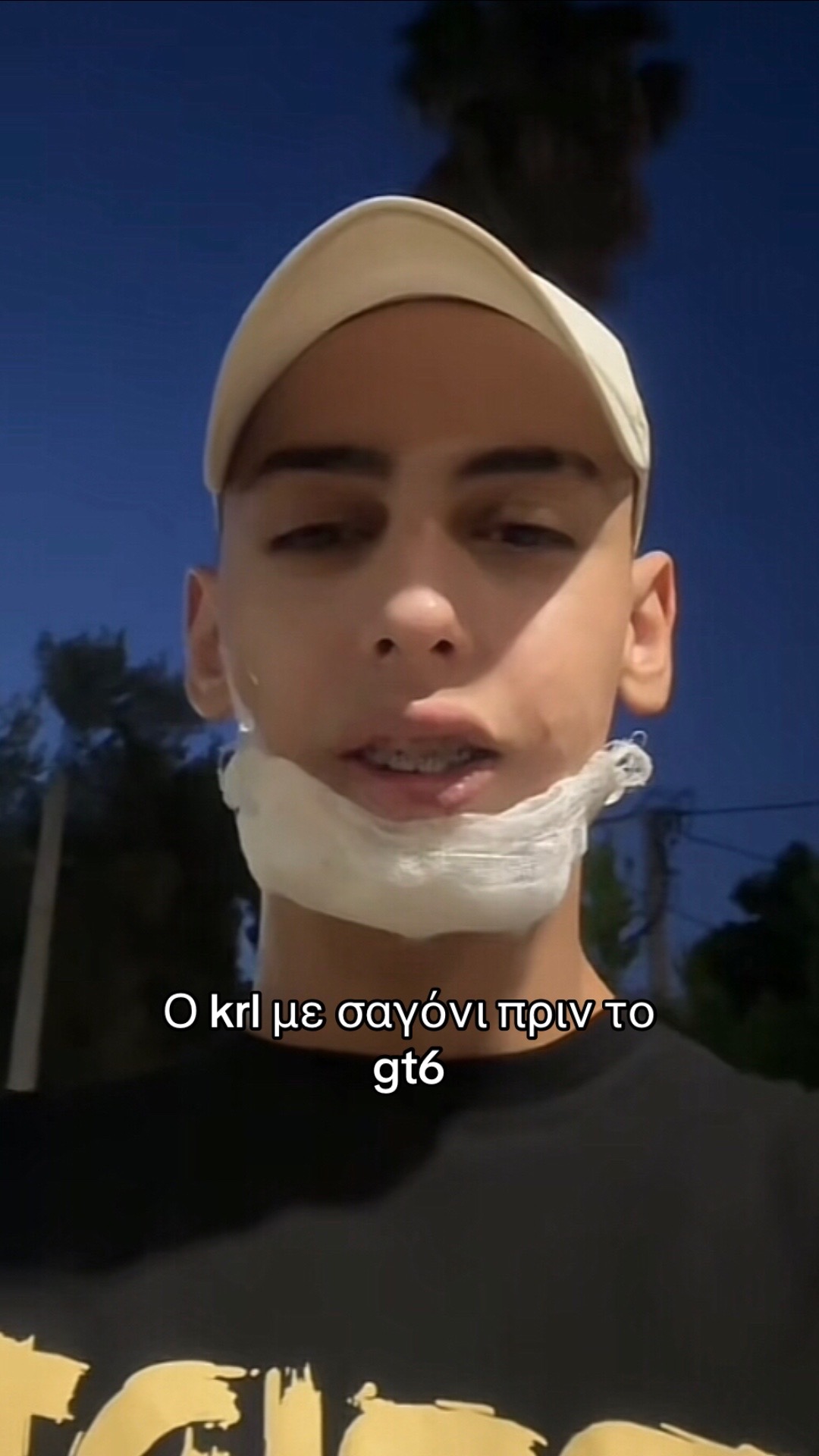 @AFT