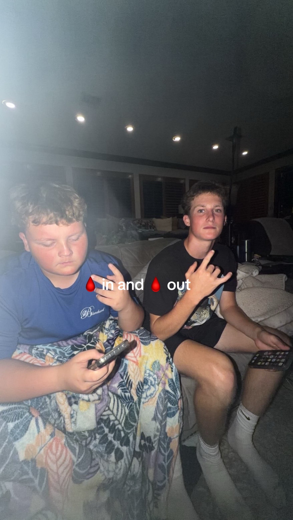 @X_gains