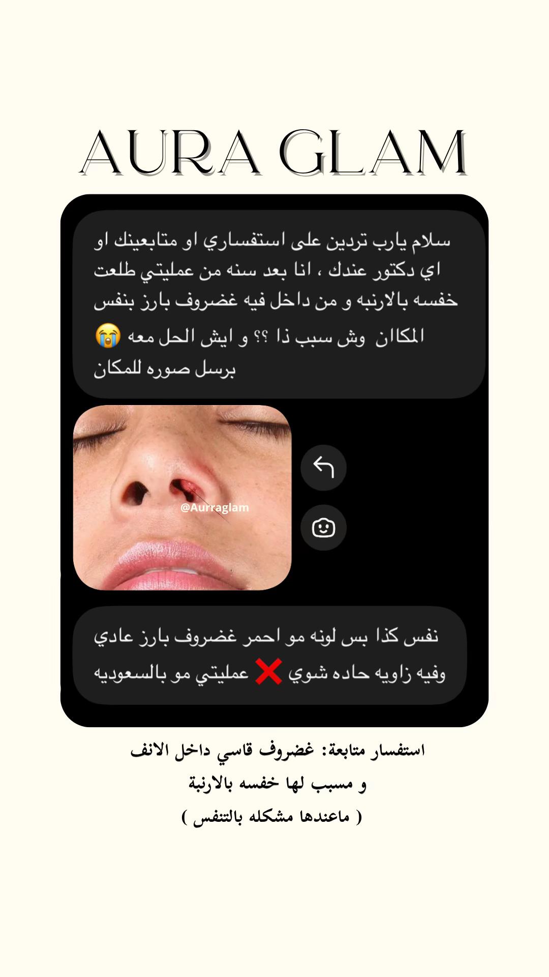 @AURA GLAM | أورا قلام