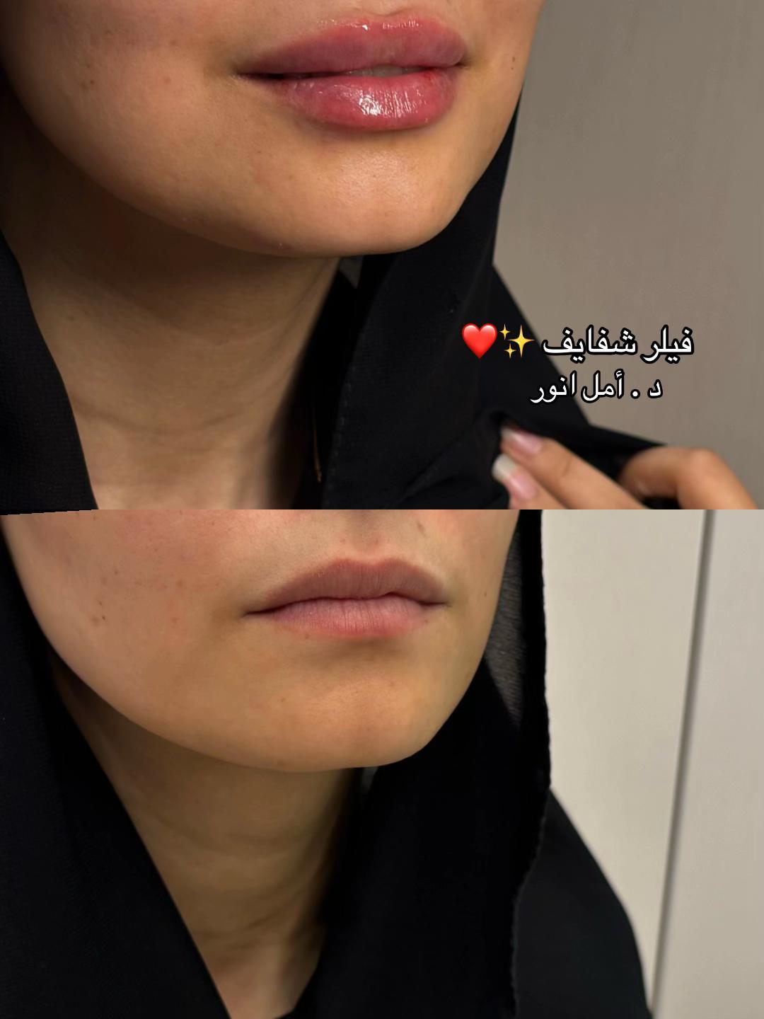 @مركز مزدانه 1 ( فرع الصحافه )