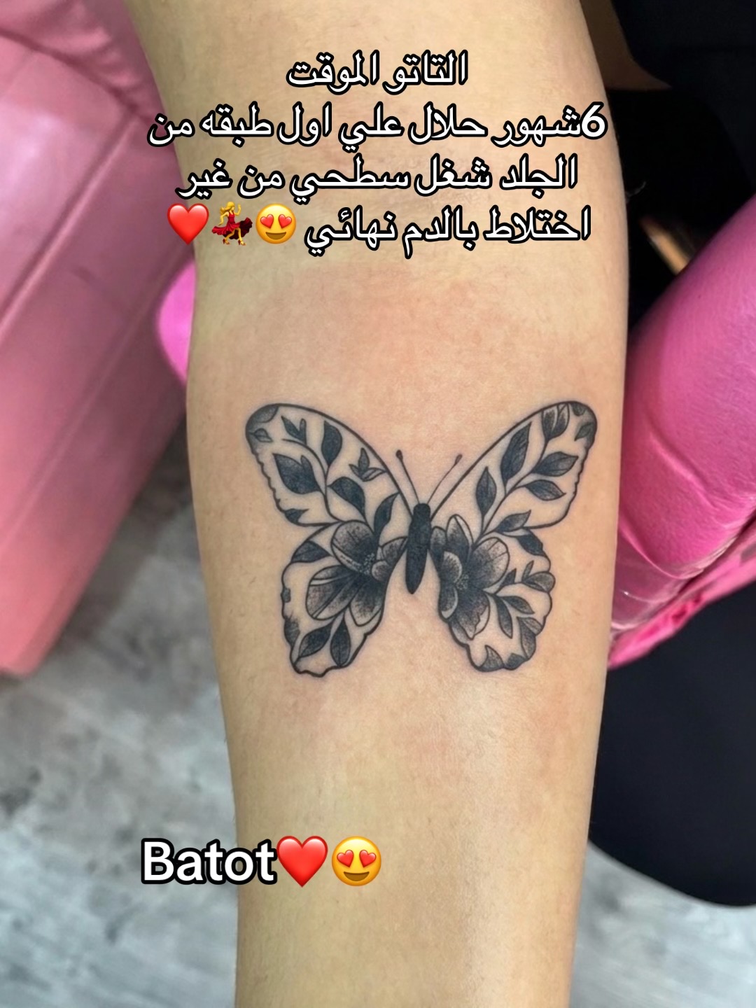 @batot💅🎀