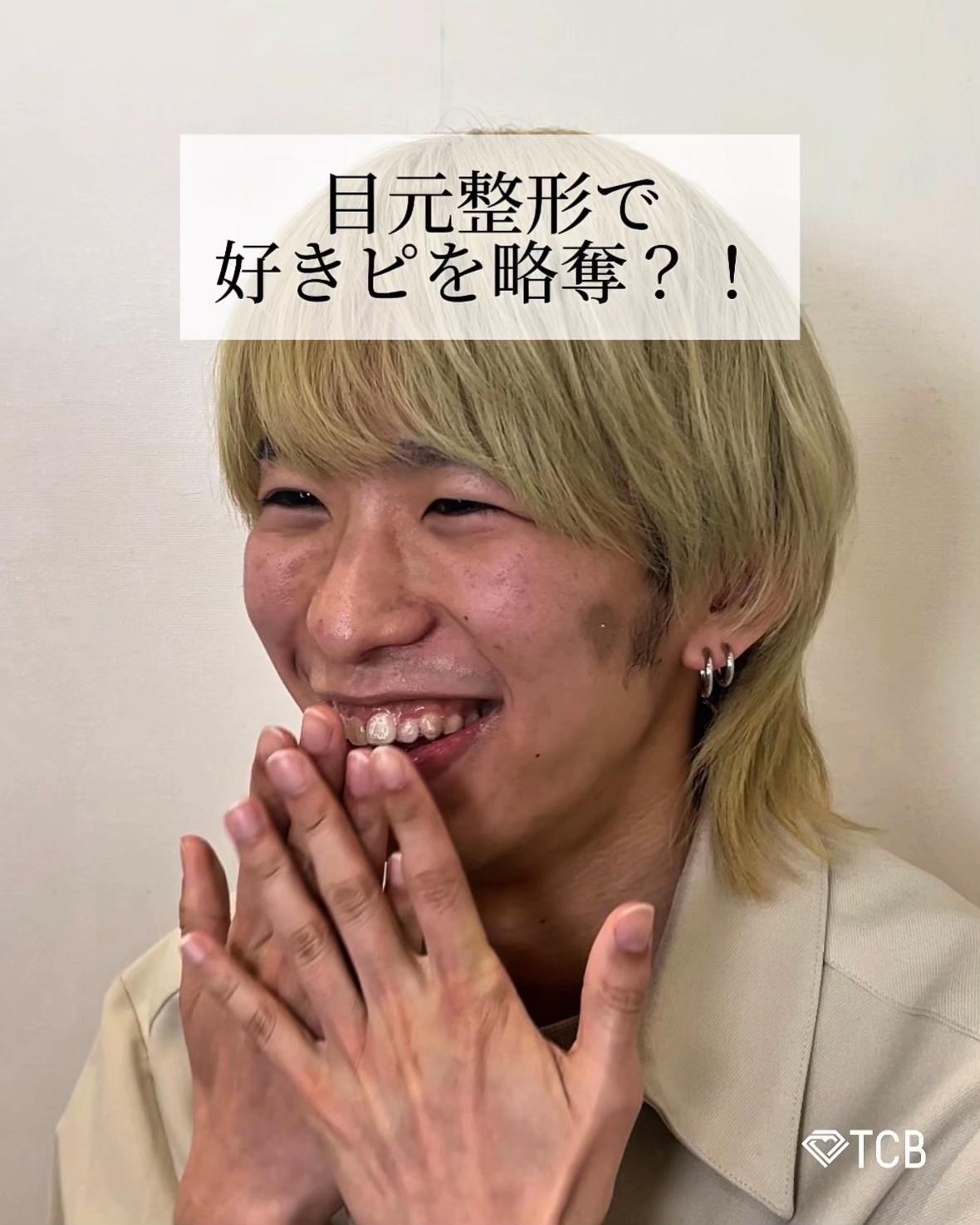 @【二重整形】TCB 新宿東口院ゆいこ先生/東京