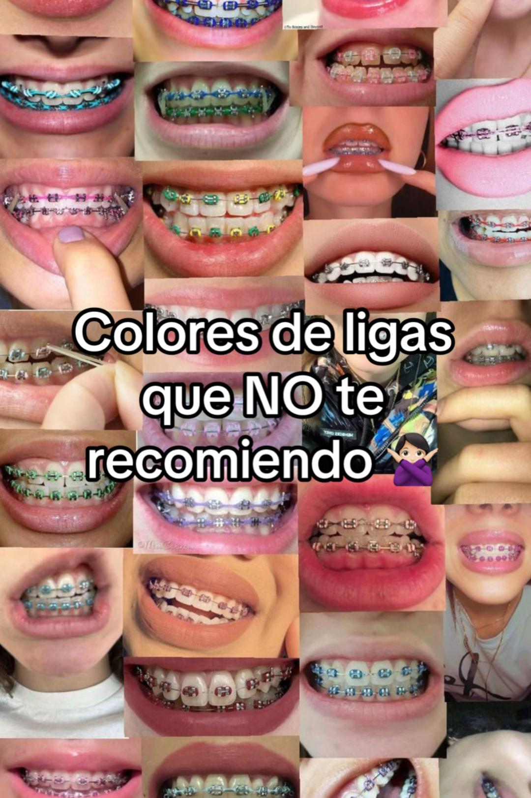 @Brackets y Alineadores