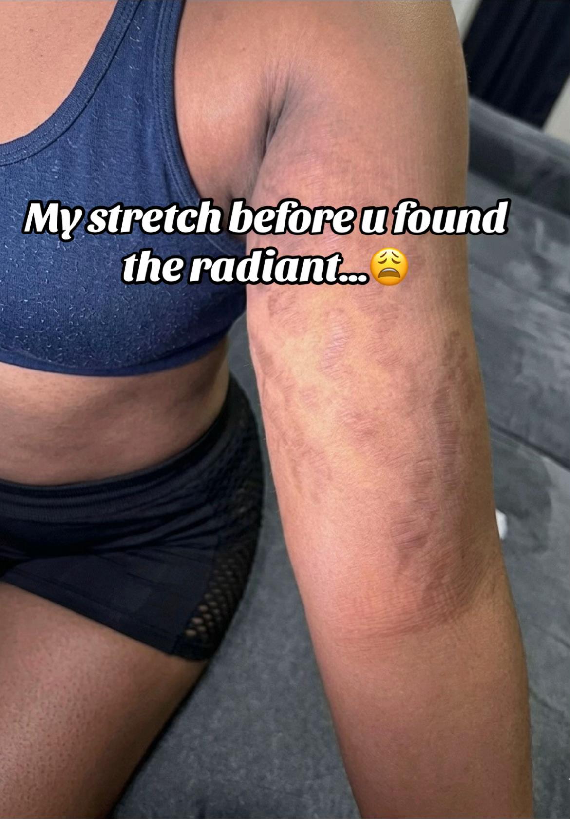@Radiant skin