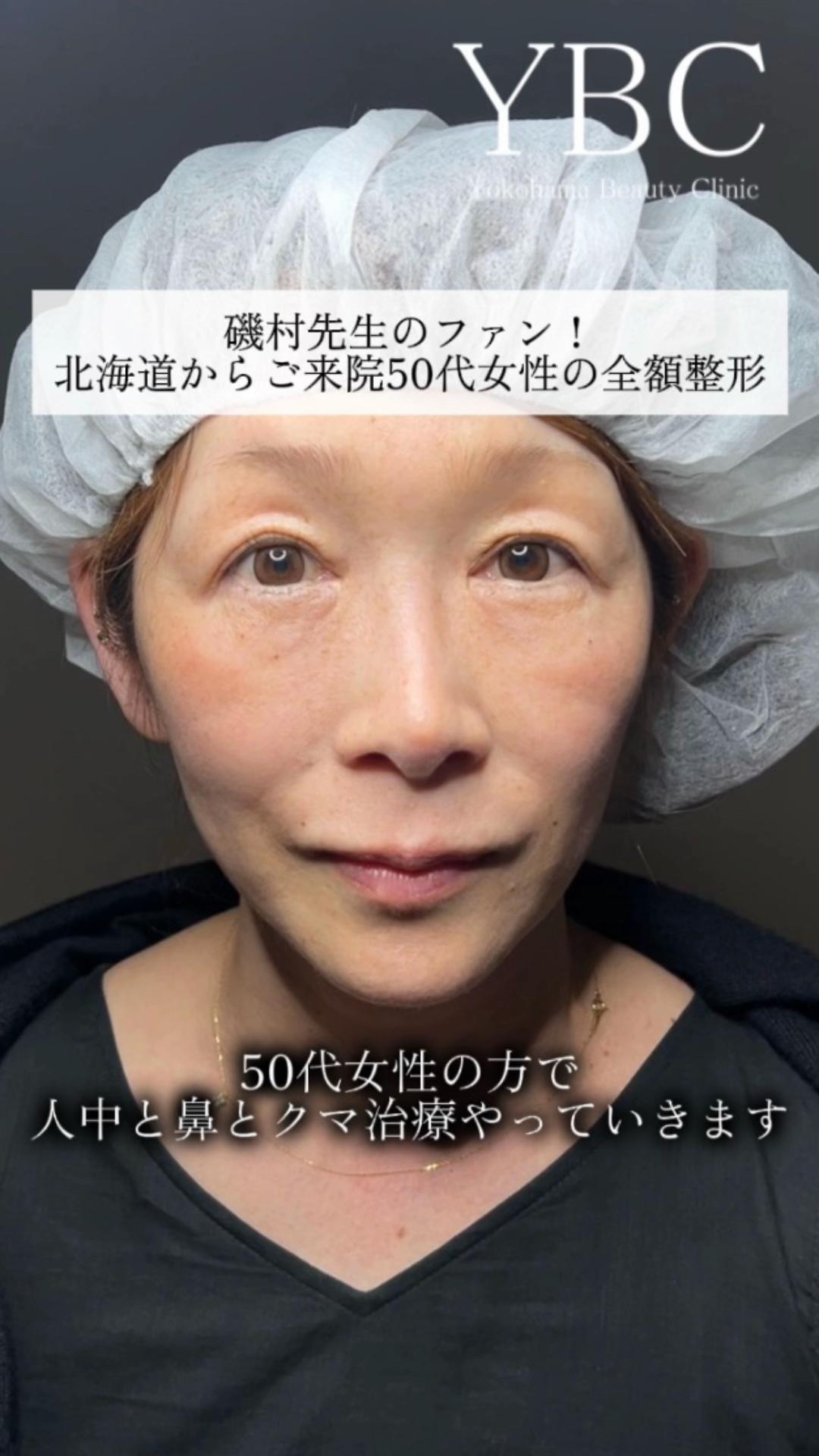 @イソセン/美容外科医（磯村亮輔院長）