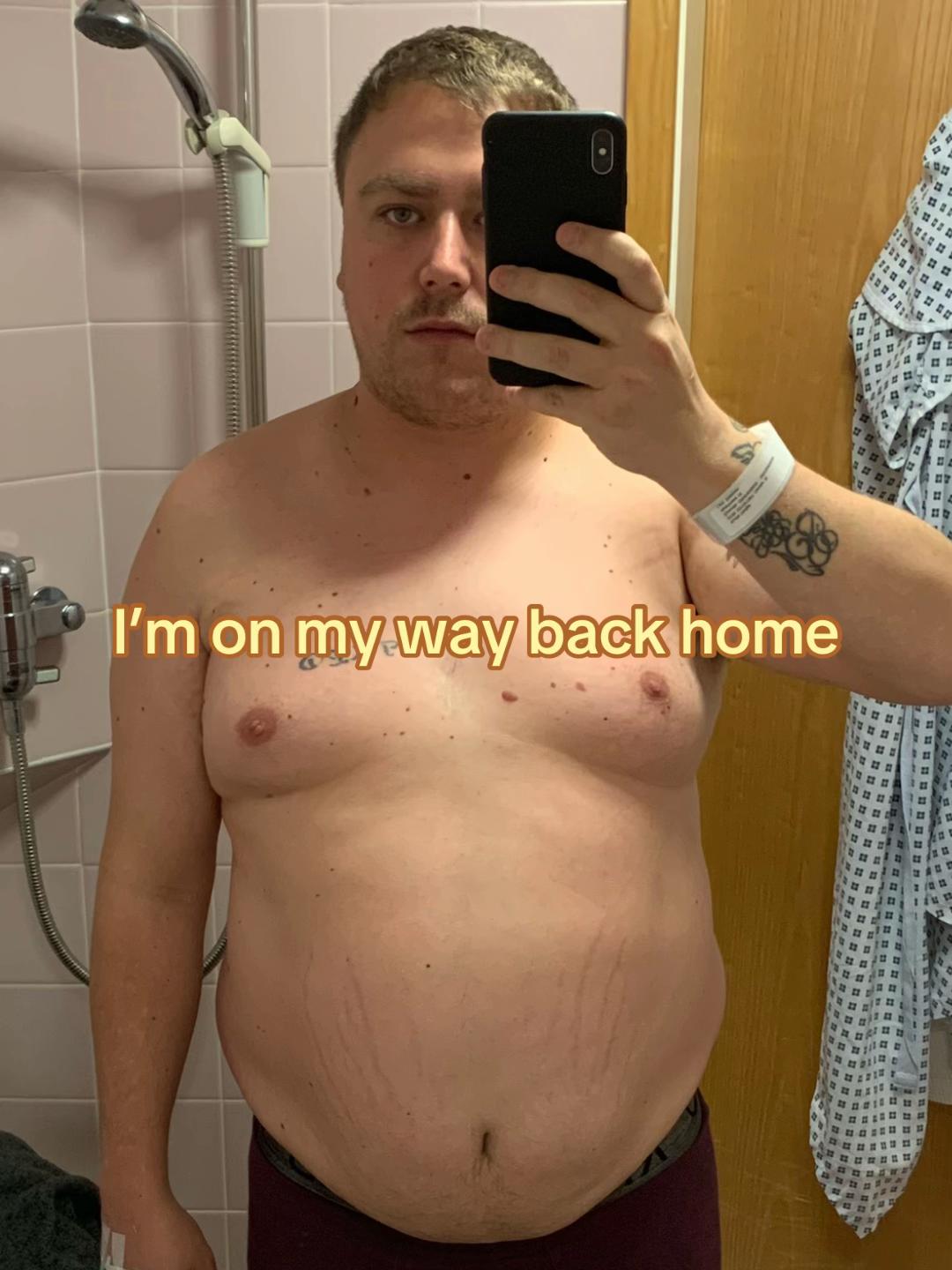 @KD | Life After Weight Loss