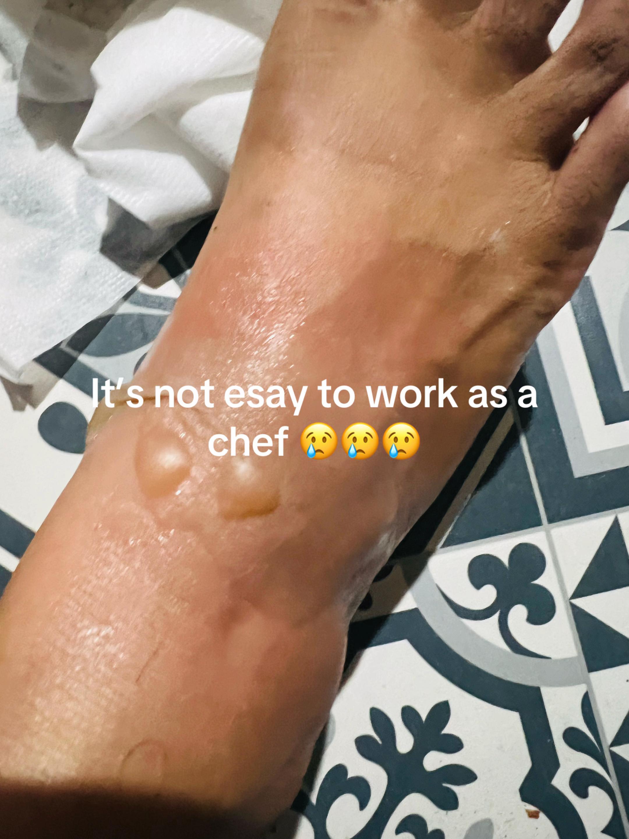 @Chef Apsara Khanal 🇦🇺