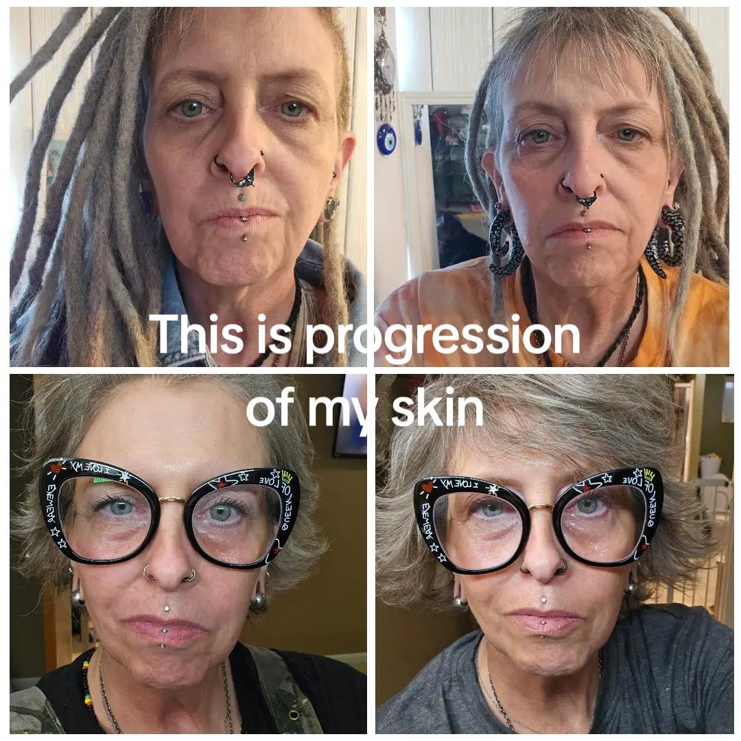 @Teri❌️Glow-up
