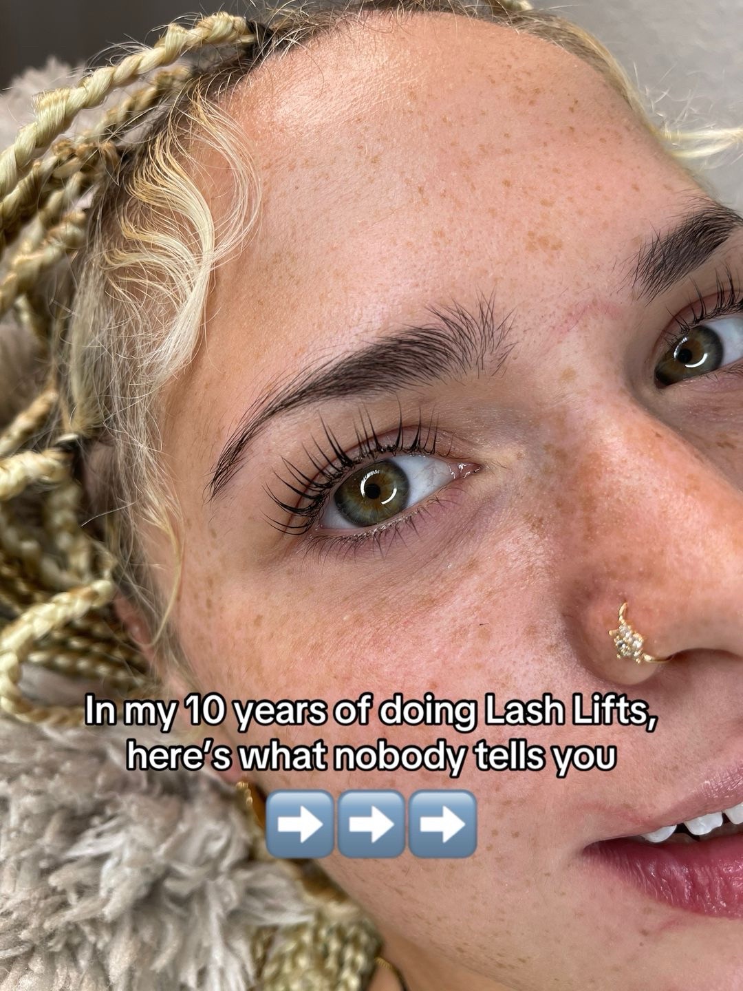 @Diandra | Teeth Whitening Tech