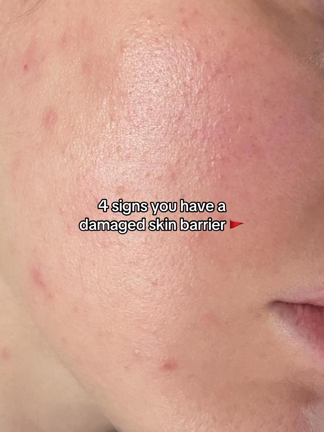 @Heaven Skincare