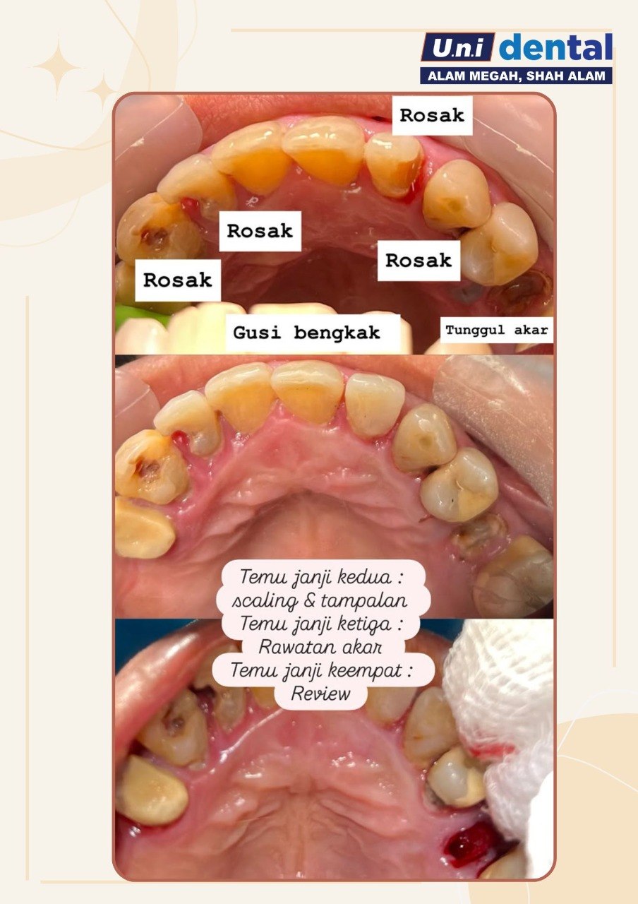 @Klinik UNI Dental Alam Megah