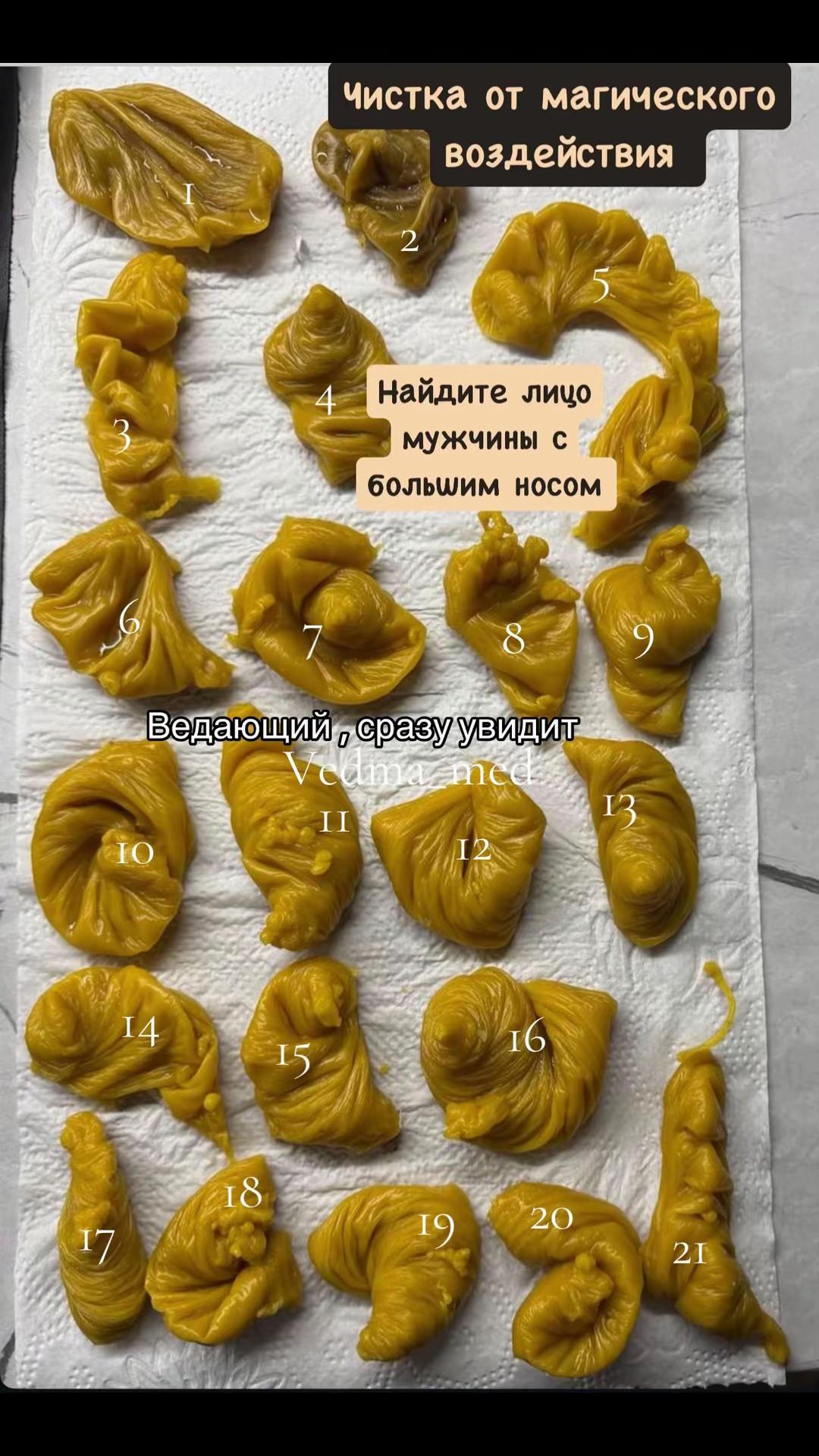 @Медицинская ведьма 🔮