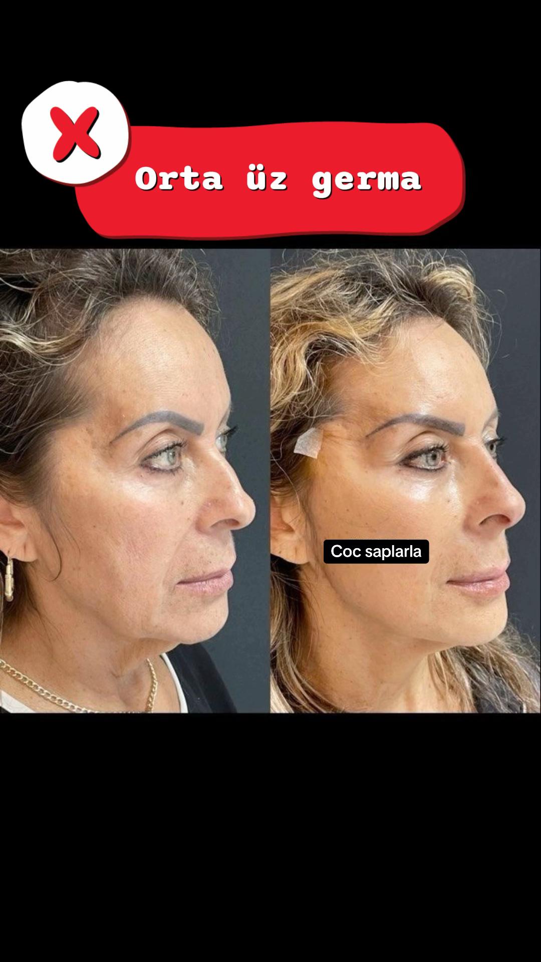 @Dr.Leyla Aesthetics