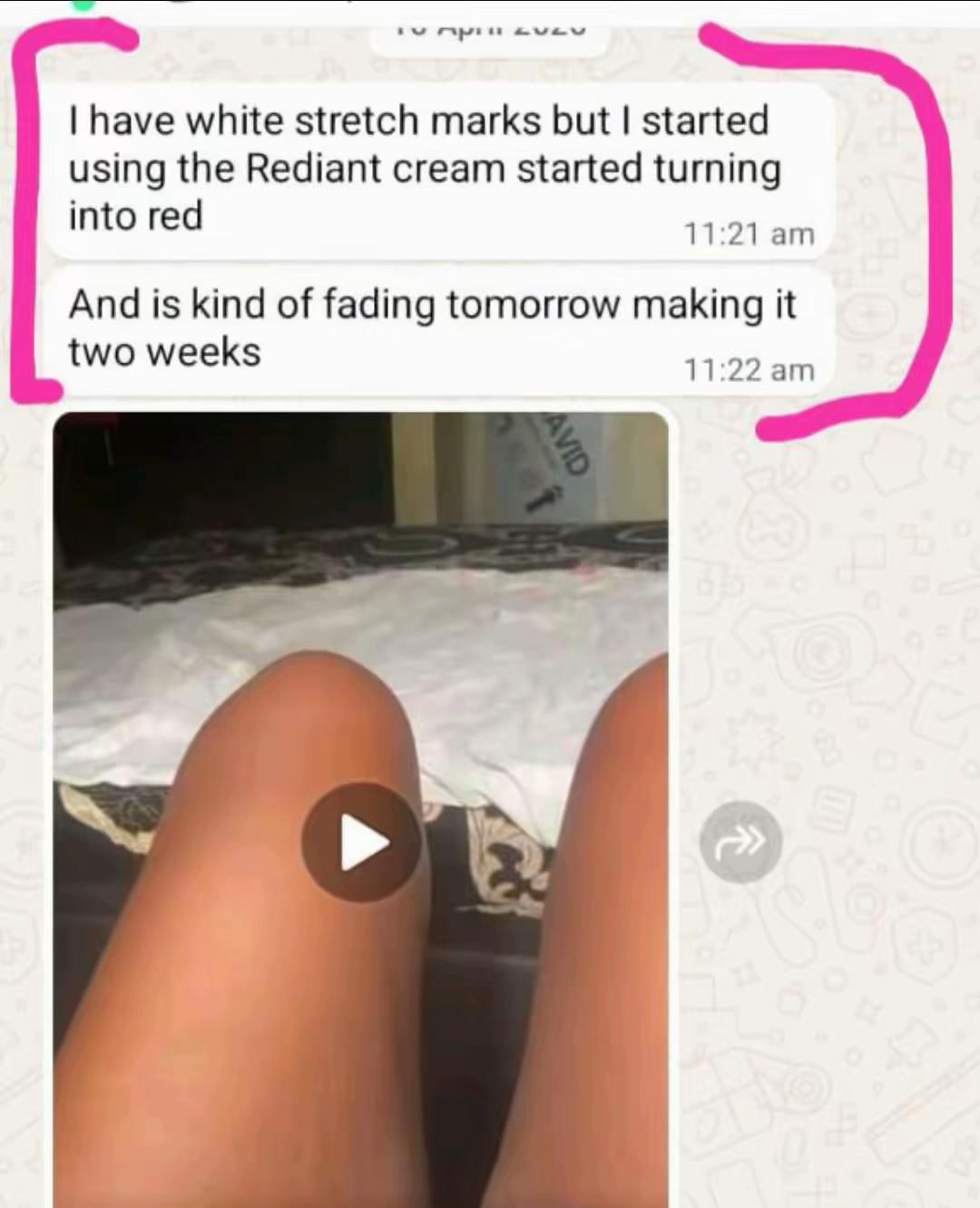 @Radiant skin
