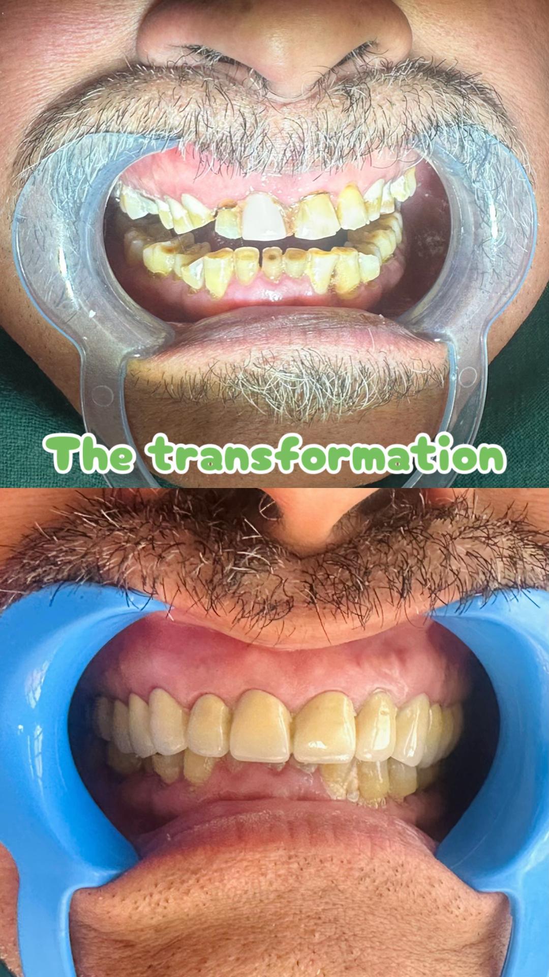 @vaidurya_dental_clinic