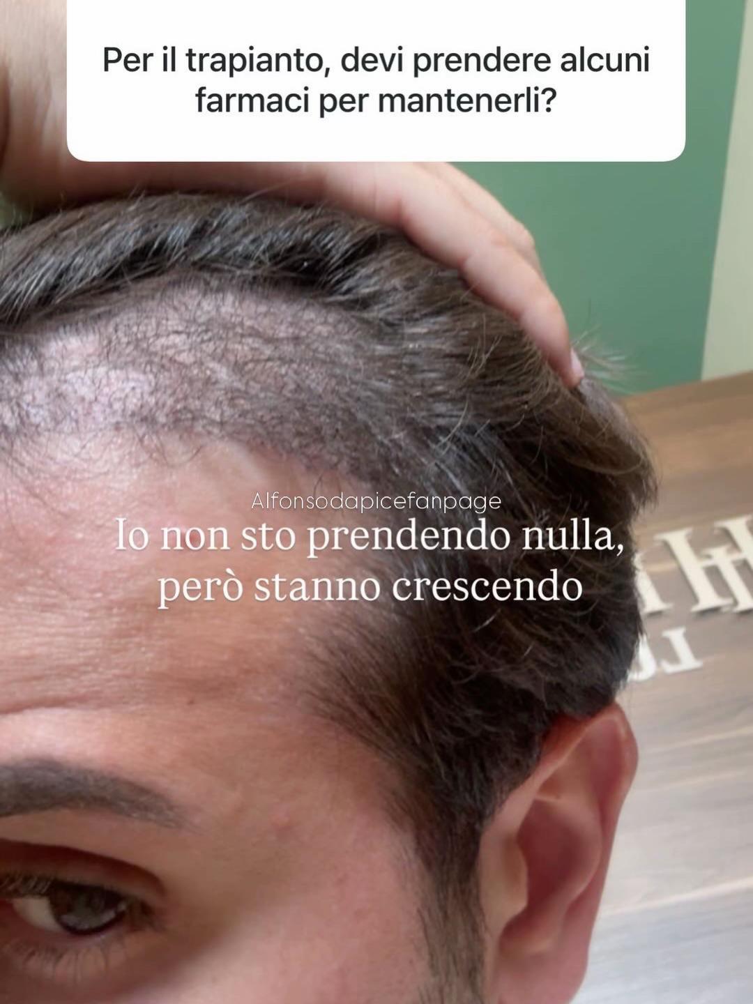 @alfonsodapicefanpage