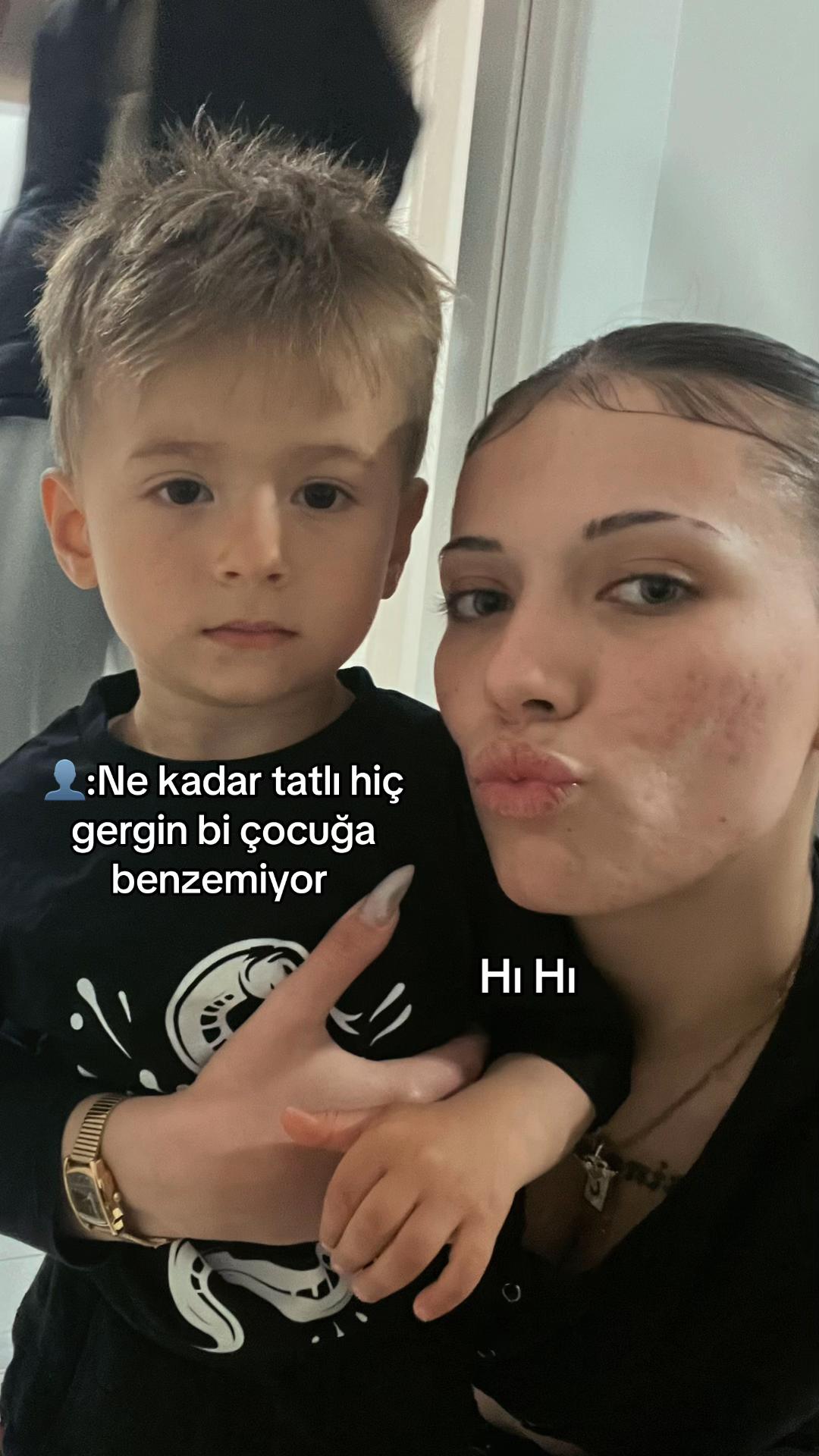 @Ceren