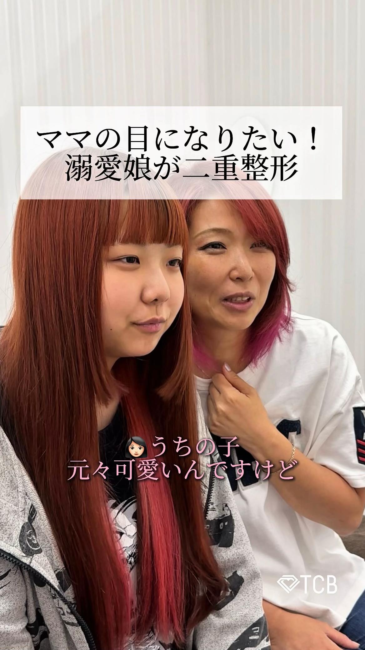 @【二重整形】TCB 新宿東口院ゆいこ先生/東京