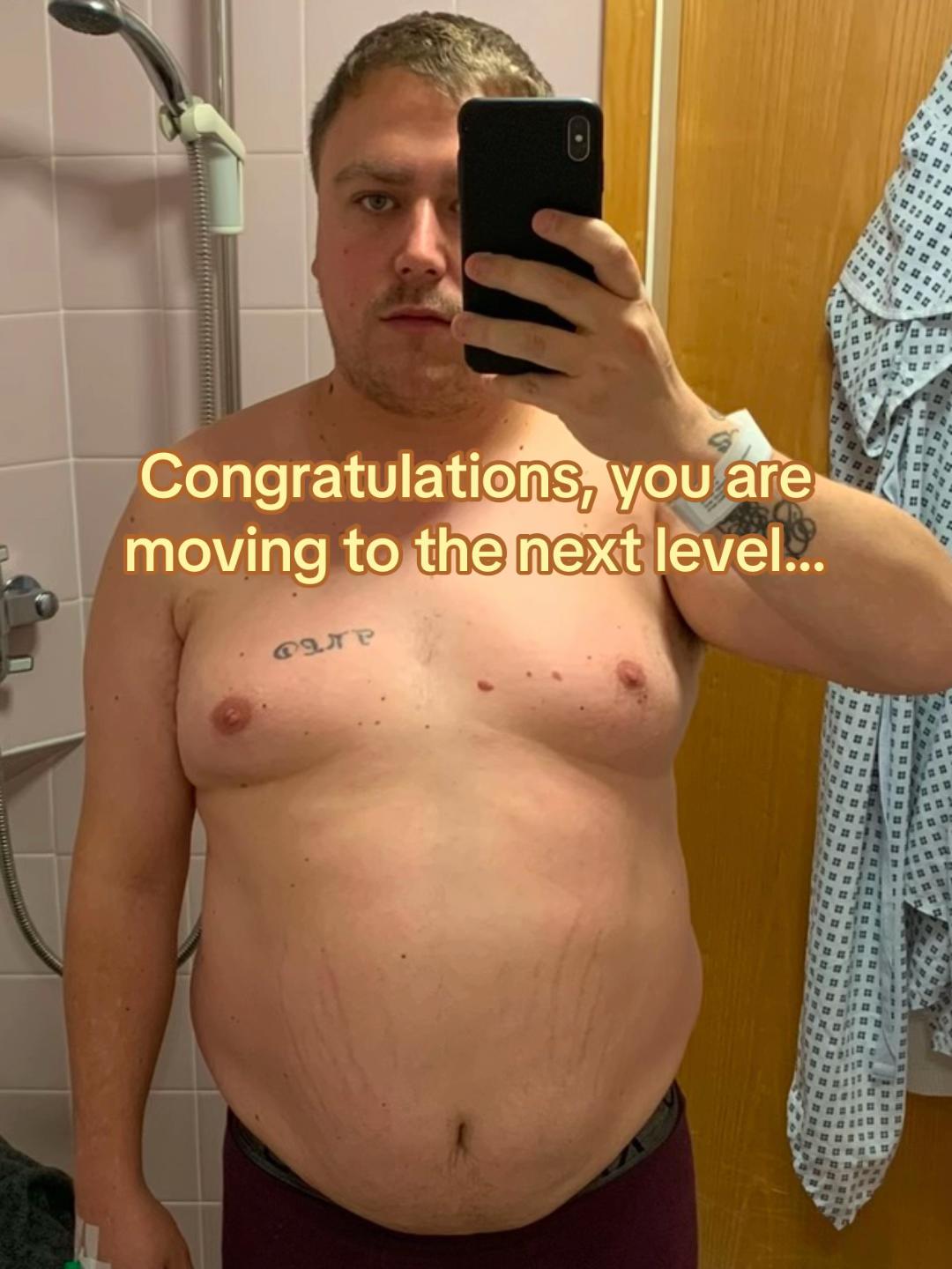 @KD | Life After Weight Loss